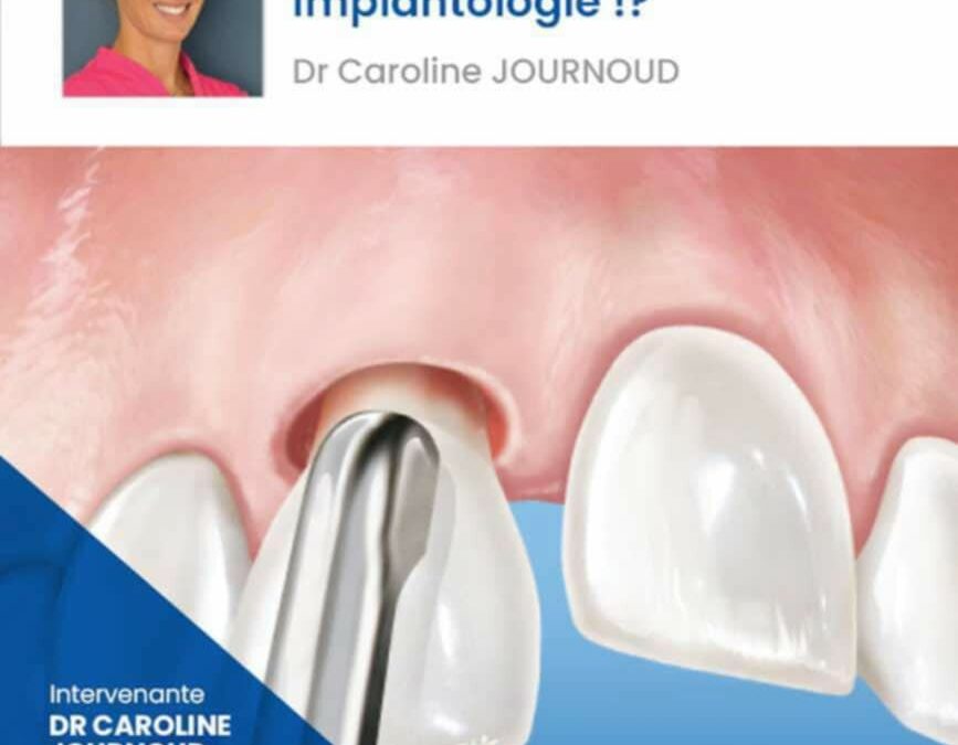 Master Class – La dent antérieure en implantologie : expertise, précision et esthétique au service du sourire